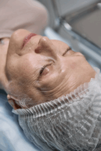 Donanemabe no TRAILBLAZER-ALZ 6: como a titulação melhora a segurança e reduz o risco de ARIA