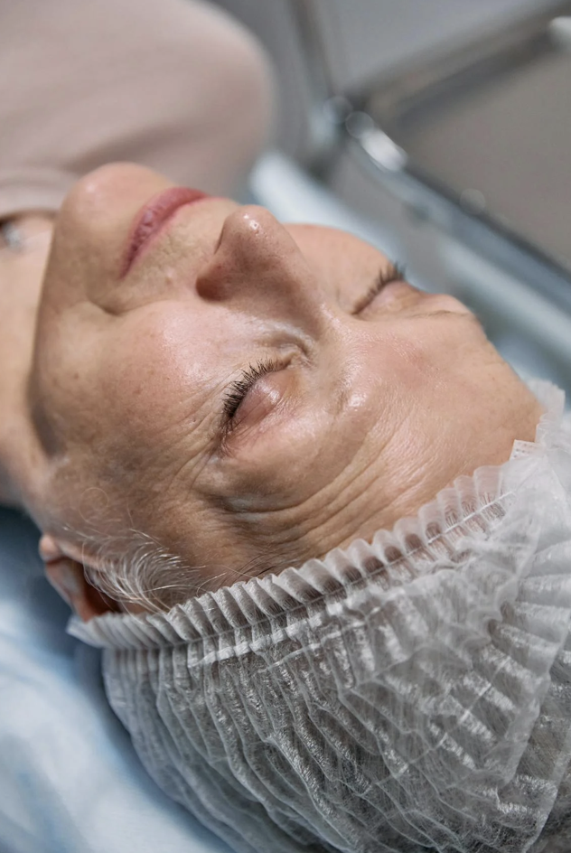 Donanemabe no TRAILBLAZER-ALZ 6: como a titulação melhora a segurança e reduz o risco de ARIA